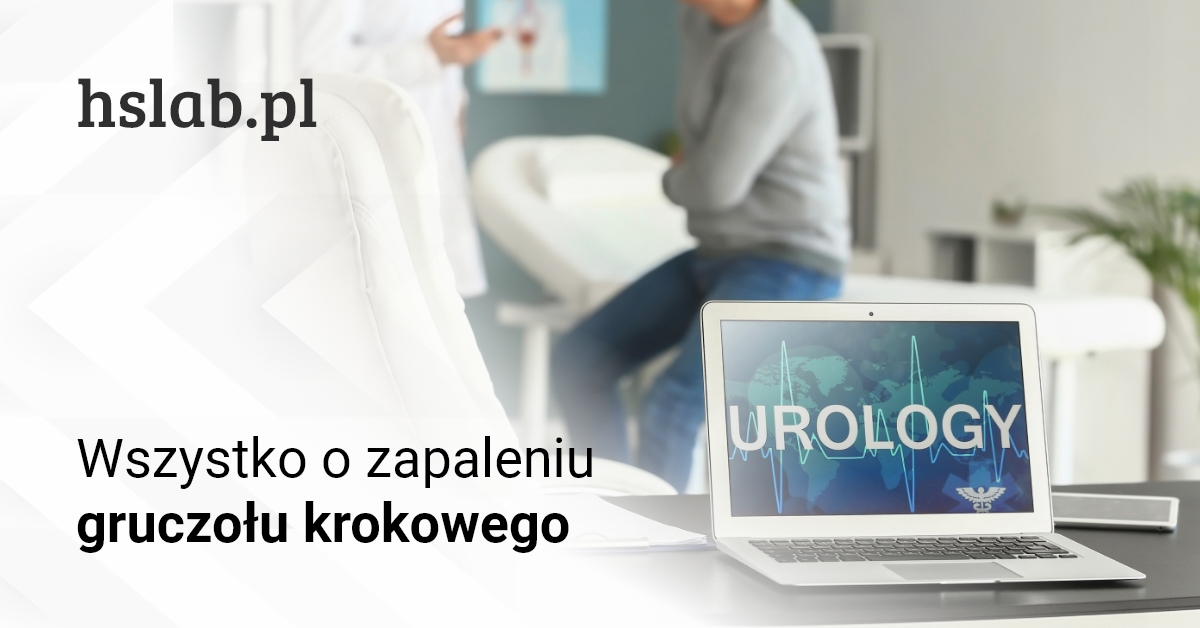 Wszystko o zapaleniu gruczołu krokowego &#8211; prostaty